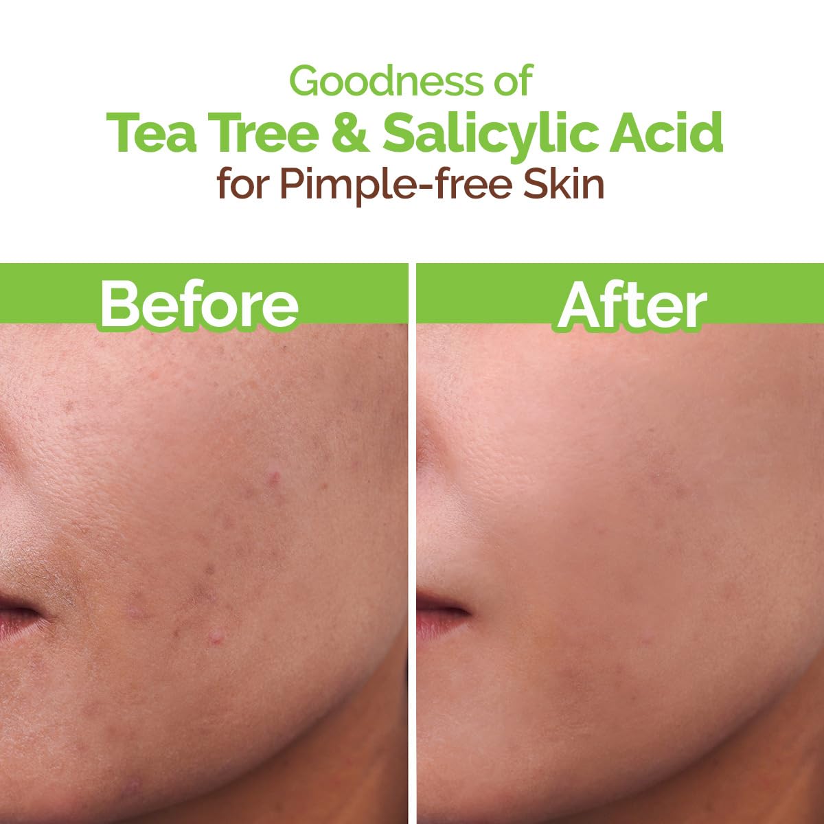 Mamaearth Tea Tree Pimple Control Face Wash For Oily & Acne-Prone Skin (100ml)